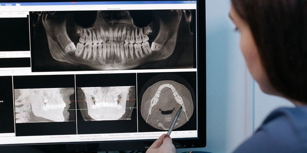 dental diagnostic technology